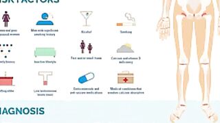 Osteoporosis overview
