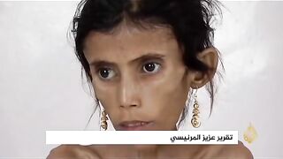 Save the children of Yemen