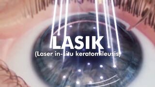 How Laser Eye Surgery (Lasik) is Performed 3D Animation (Urdu Hindi)