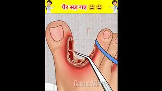 पैर सड़ने का इलाज????????, 3d animation| Good woodworking art skills