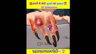 3D animation hands treatment