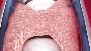How Thyroid Gland Is Removed (3D Animation) shorts