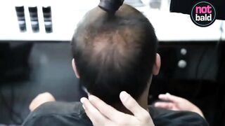 Product to hide lack of hair