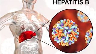 Hepatitis B symptoms causes diagnosis & treatment