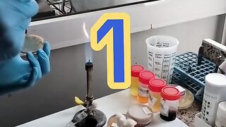 Les étapes d'un antibiogramme