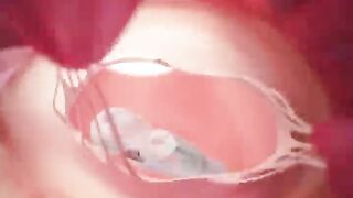 Heart valve installation