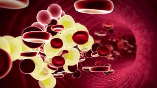 Hyperlipidaemia symptoms, causes, diagnosis & treatment