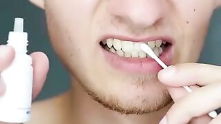 Santé ,les dent guérir~Health, teeth heal