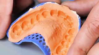 Stylish grills to literally capture the beauty of your teeth!