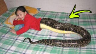 10 UNUSUAL People With Shocking Genetic Mutations.