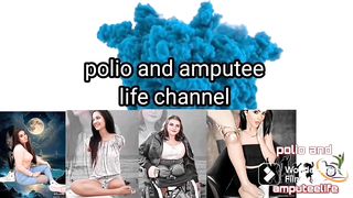 Pólio mulheres perna fina 2