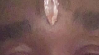 Lil Uzi Vert’s $24 Million forehead diamond ripped out #shorts