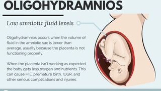 Oligohydramnios symptoms, causes, diagnosis & treatment