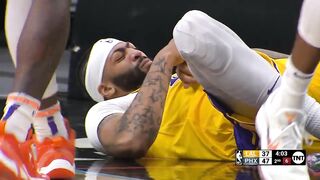 Anthony Davis Injury hand and Lakers bench worries