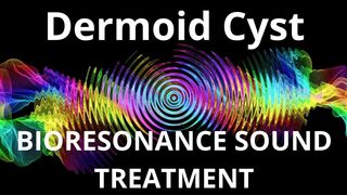 Dermoid Cyst_Session of resonance therapy_BIORESONANCE SOUND THERAPY