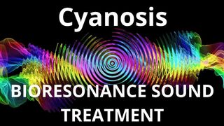 Cyanosis_Session of resonance therapy_BIORESONANCE SOUND THERAPY