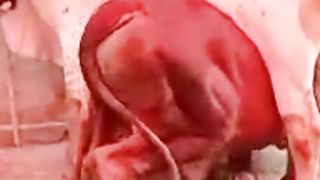 Apne he girate hai nashyman py bijliya????????