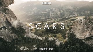Music 164