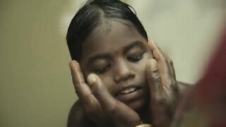 Two blind sisters see for the first time