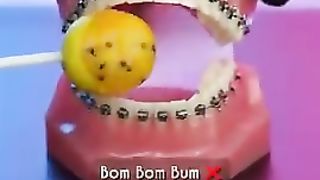 %C2%BFQue_comer_con_brackets_en_%F0%9F%87%A8%F0%9F%87%B4___-_Odontolog%C3%ADa_L%C3%
