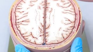 Brain 3