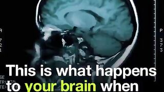 Exercise has numerous benefits for the brain.????