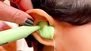 क्यों कानों के अंदर लिक्वीड पेस्ट भरा जाता है