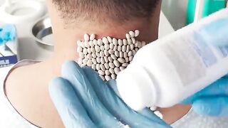 His neck is covered with parasites????