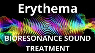 Erythema_Session of resonance therapy_BIORESONANCE SOUND THERAPY