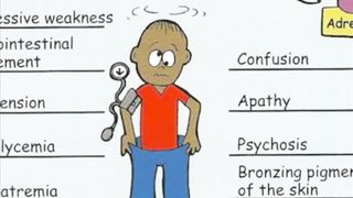 Addison's disease overview