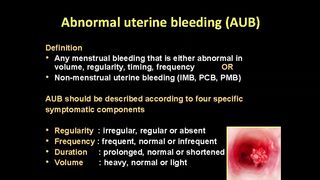 Abnormal uterine bleeding symptoms, causes, diagnosis & treatment