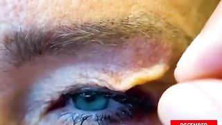 how to get rid of wrinkles on face