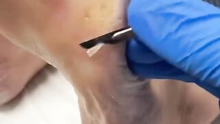 Video 157