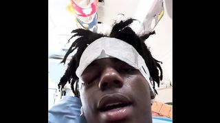 ISHOWSPEED Surgery Or Beaten By Someone
