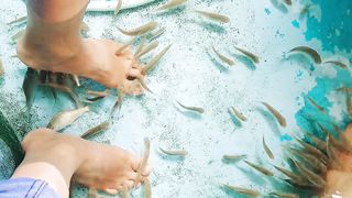 Ikan terapi untuk menyembuhkan berbagai macam penyakit kulit