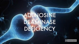 ADENOSINE DEAMINASE DEFICIENCY