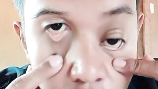 Mata asli.bukan editan..beda sebelah