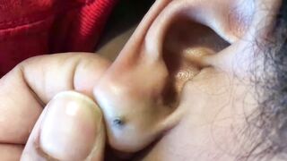 You won't believe what was in her earring hole, Black head