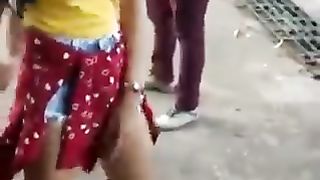 The accidental fall
