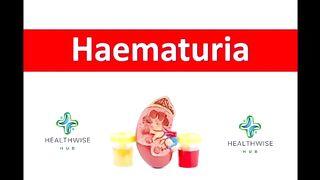 Bloodline| Chronicles |haematuria |blood in the urine |explained |preventing and Managing Haematuria