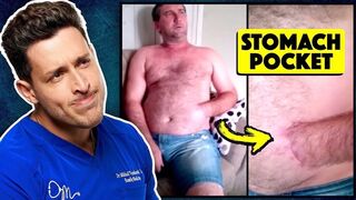 Doctor reacts to extreme medical conditions