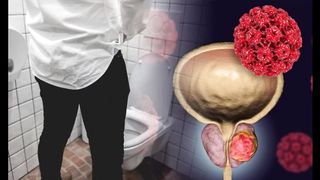 Fluxactive Complete Reviews: Benefits, Cons Dosage,Price Must Watch!