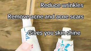 Skin A if you have sensitive skin please dont use this.. tritinione apaplene me hai so you use this instead of skin a.