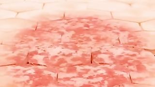 Skin Medix Psoriasis