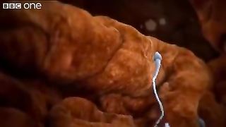 Sperm attacked
