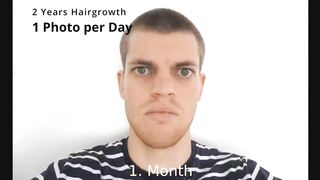 Hair grow time lapse two years