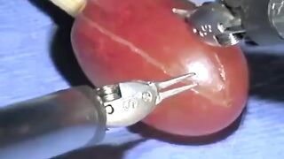 Grape Operation