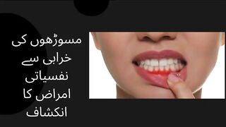 Psychiatric disorders revealed by gum disease