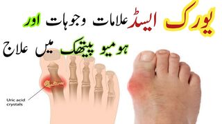 Control uric acid, joint pain & swelling | uric acid | uric acid home remedies