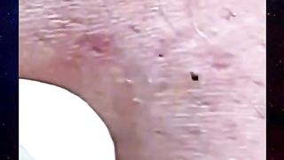 Éjection